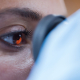Glaucoma eye exam