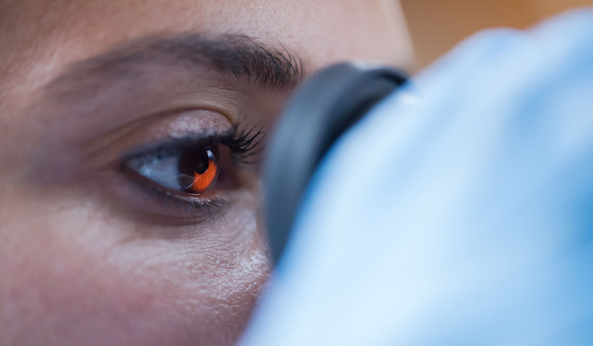 Glaucoma eye exam