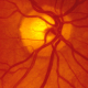 retinal vessels up close