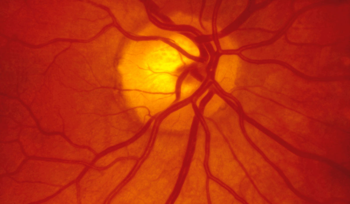 retinal vessels up close